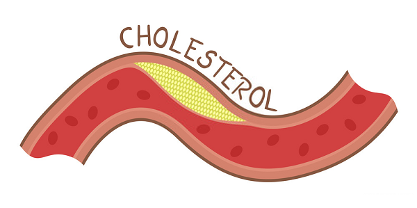 Cholesterol đóng vai trò quan trọng trong cơ thể