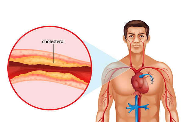 HDL ­– Cholesterol có vai trò quan trọng trong sự trao đổi chất và vận chuyển máu đi các cơ quan